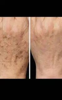 کرم دست وصورت
