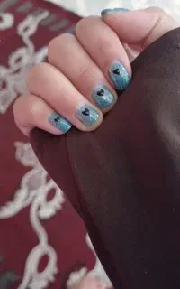 ریموو در 20دقیقه