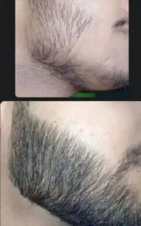 صورتت و سرت رو مثل جنگل کن