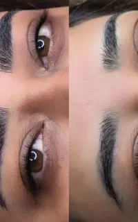 میکروبلیدینگ فیبروز/ شیدینگ لب/بن مژه