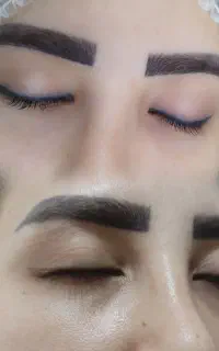 اف ویژه ریموو انواع تتوها