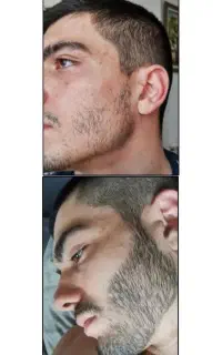رویش مجدد‌ و تضمینی