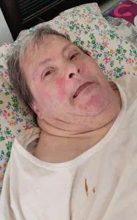 پرستار  آقای سالمند سندرم داون
