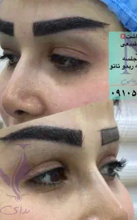 کاشت ابرو طبیعی و ماندگار