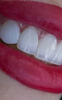 خدمات دندان پزشکی/شرایط اقساطی/کلینیک