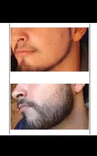 لحظه ریش داشتن رسیده