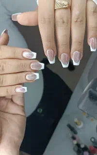 کاشت تخفیفی ویژه ۲۵۰ شیدینگ ۷۰۰