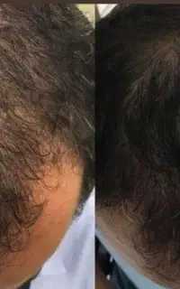 موهای پرپشت تر اعتماد به نفس بیشتر