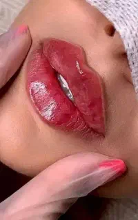 تزریق فیلرژل مزوژل جوانساز.... باتخفیفات ۵۰درصدی