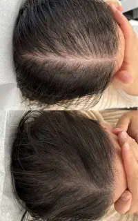 روغن هیر استار /قطع ریزش/رشد ۱۰سانتی مو