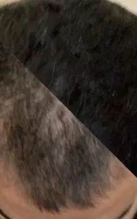 نانو کیت