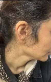 کلینیک شنوایی و سمعک دی/ از دم قسط بدون پیش پرداخت