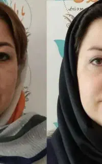 کرم بوتاکس/بیوممتیک جایگزین فیلرو بوتاکس