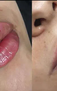 مطب زیبایی دکتر انصاری ،لیزر،زیبایی و کلینیک لاغری