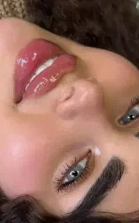 ژل فقط ۶۸۰وبوتاکس ۸۸۰پی آرپی ۱۲۰۰