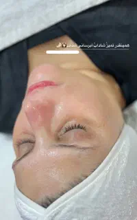 فیشال تخصصی پوست + هدیه فیشال دست