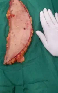 ابدومینو پلاستی.ماموپلاستی.جراحی زیبایی
