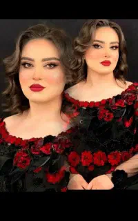 تخفیف لاین های زیبایی