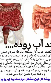 درمان یبوست باگیاه درمانی