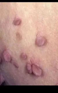 خال
