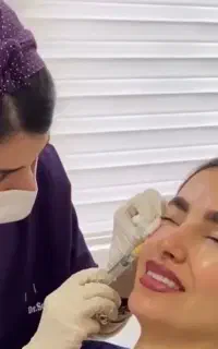 تزریق بوتاکس صورت با بیمه تامین اجتماعی مطب پزشکی