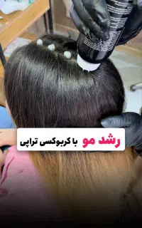 آموزش اسکراب اسکالپ(پاکسازی کف سر)