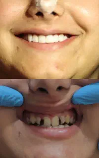 دندانپزشکی (تخفیف ویژه)