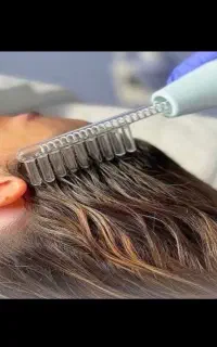 هایفوتراپی پوست و مو تخصصی