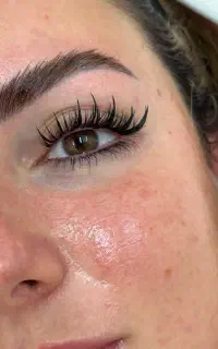 کاشت مژه هیدن (اکستشن نیست)