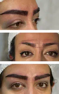 کاشت ابرو دائمی با تیم از رشت- پرداخت دومرحله ای