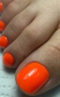 ترمیم دست و پا ((250))