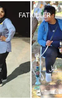 لاغری صدرصد تضمینی(بدون عمل)