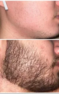 ریش چهرتو خیلی پخته میکنه