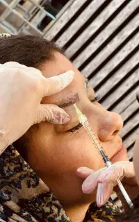 کاشت مو ژل بوتاکس فیلر لیزر با تسویه اقساطی