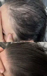 شروع دوباره رویش
