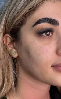 پیرسینگ مطبی گوش غضروف،گوشواره کودک، میکرودرمال