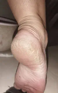 پدیکور تخصصی پا با نازلترین قیمت