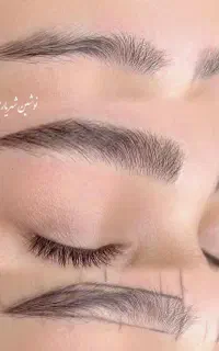 اجاره لاین زیبایی