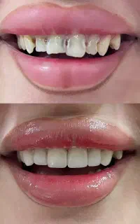 خدمات دندانپزشکی با بهترین تعرفه