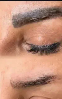 لیزر تاتو کیوسوییچ ۲۰۲۴ و کربن