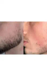 ریش مرتب و اراسته نشان دهنده شخصیت قدرتمند