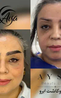جشنواره طلایی میکروکاشت ابرو باخواب طبیعی