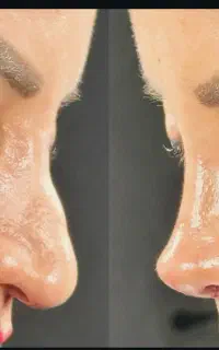 عمل بینی با ما
