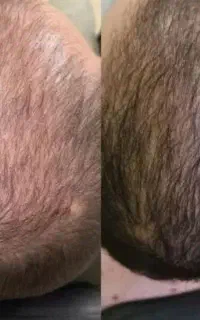 زیبایی رو به خودت هدیه بده