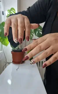 مدل کاشت وترمیم ناخن