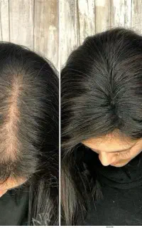 افزایش تراکم های طبیعی