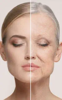 آموزش مزو نیدلینگ مزو ژل کلاژن از 5/998 مدل از 498
