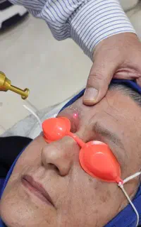 پاک کردن تتو ابرو و بدن (دکتر علی بابایی)