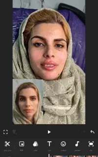 فیلر بوتاکس و فیلربادی