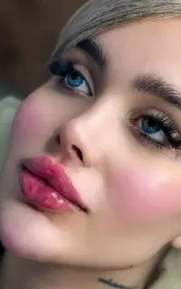 تخفیف ژل و بوتاکس آنزیم پی ار پی مزوتراپی بایوفیلر
